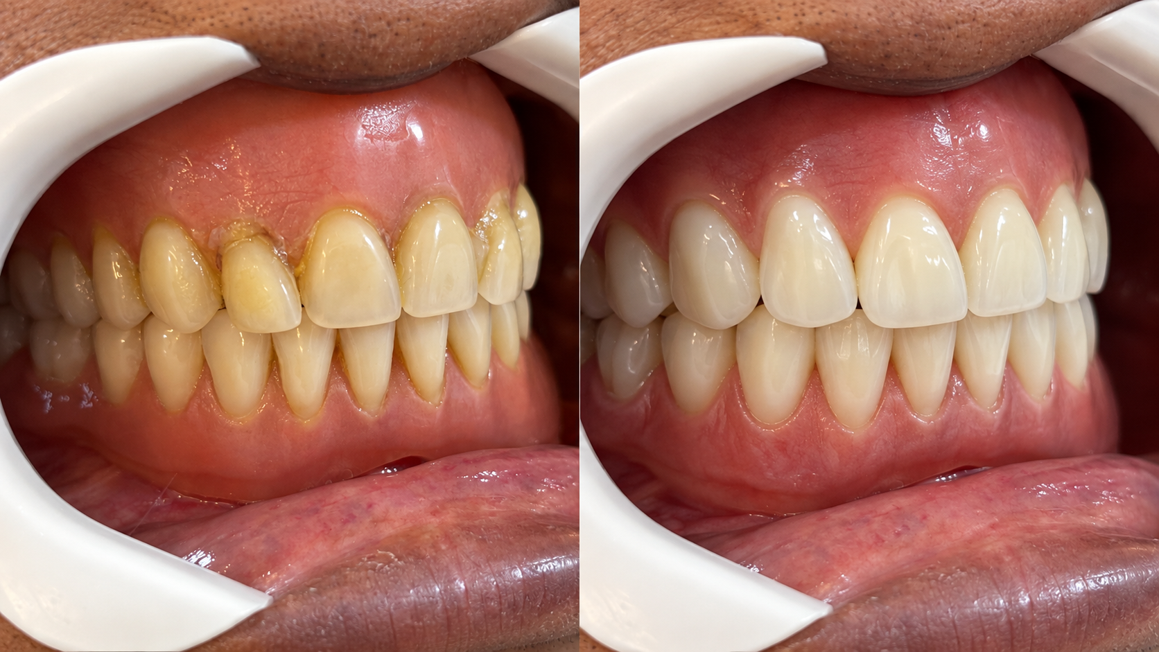 Procedimento odontológico realizado no consultório